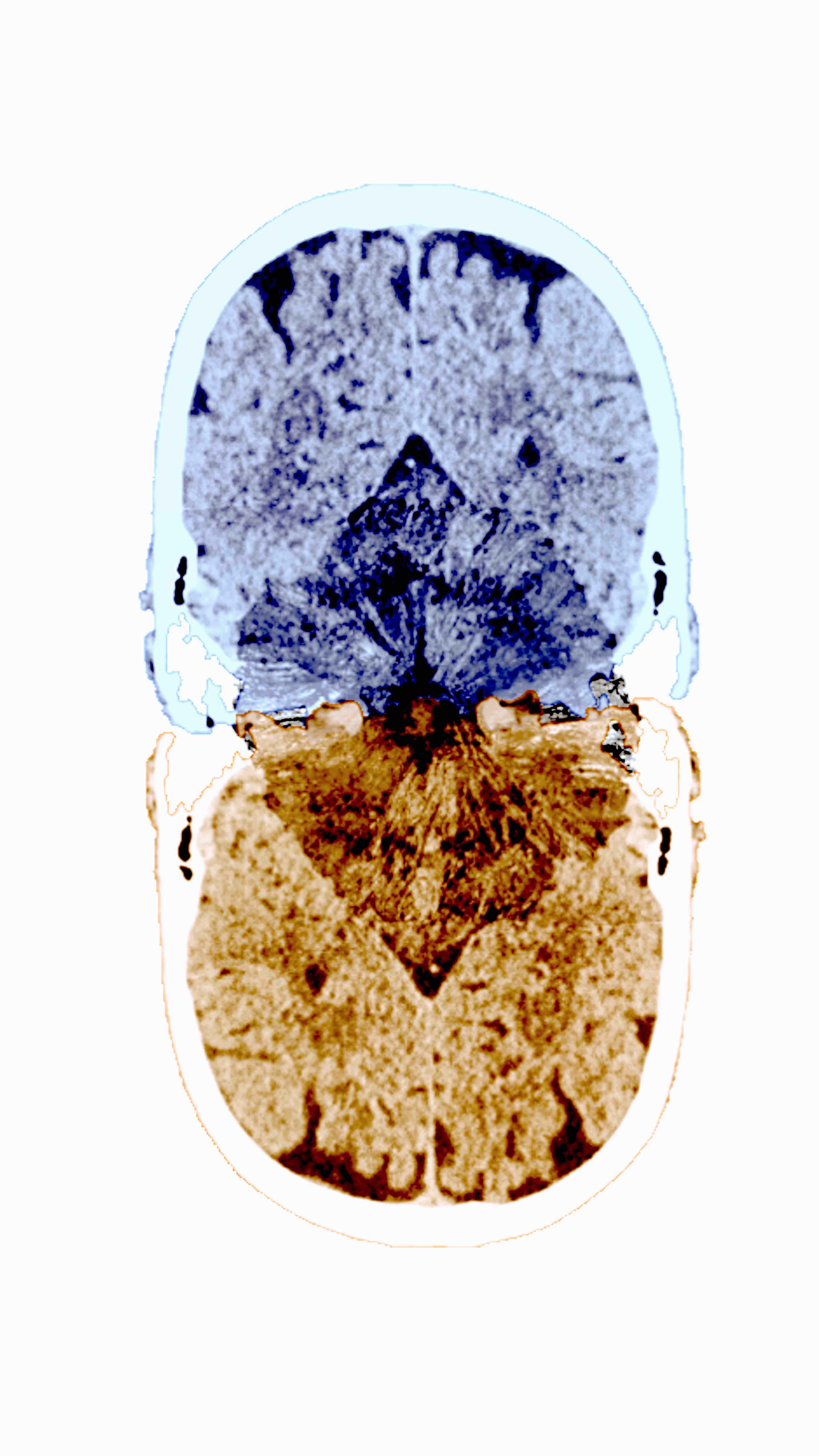 Brain Space